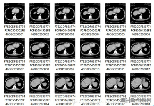 microdicom viewer图片7