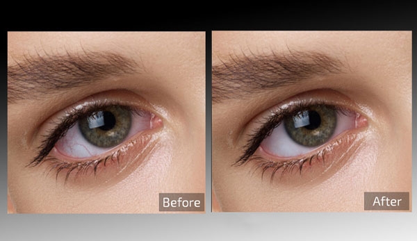 Retouch4me Eye Vessels截图