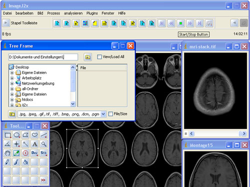 ImageJ2x截图1